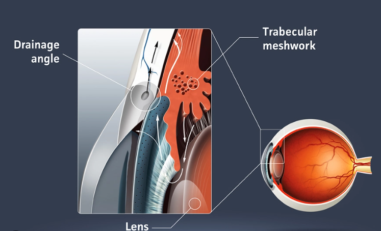 Glaucoma Specialist near me