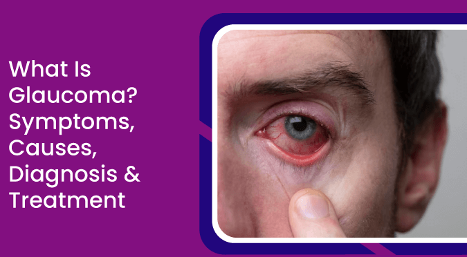 Glaucoma Treatment in Vadodara